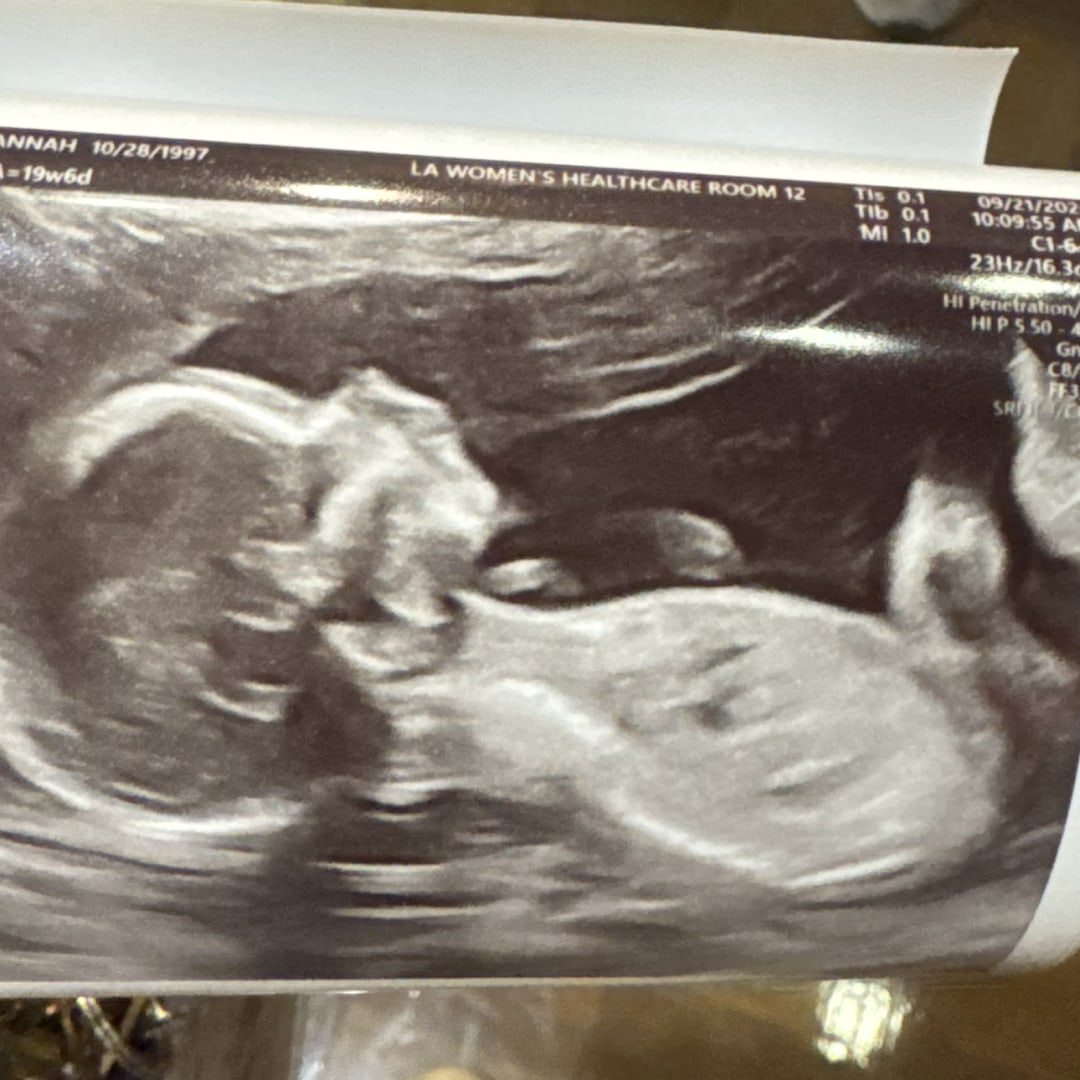 Photo shared by Hannah for their Babylist baby registry.