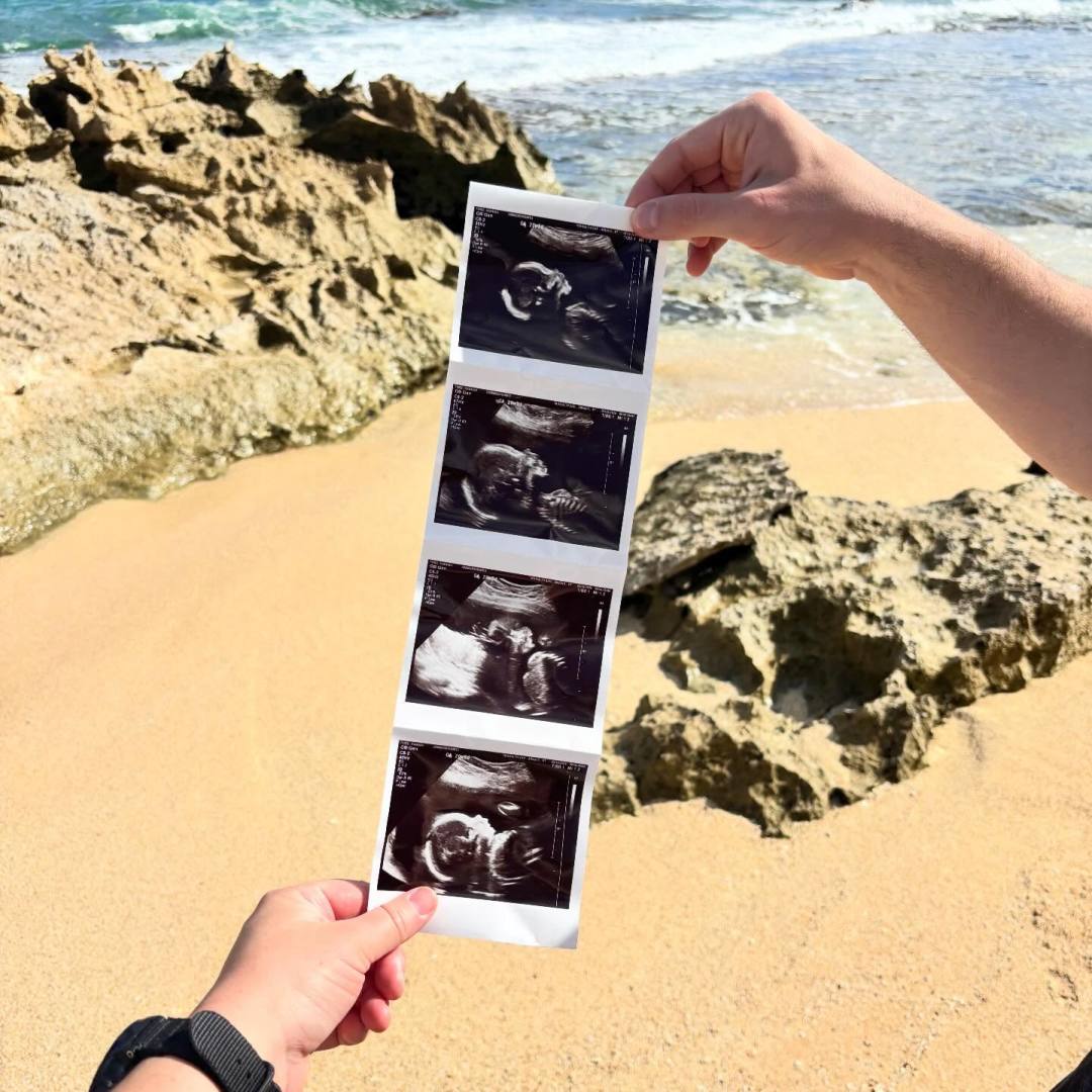 Photo shared by Hannah for their Babylist baby registry.