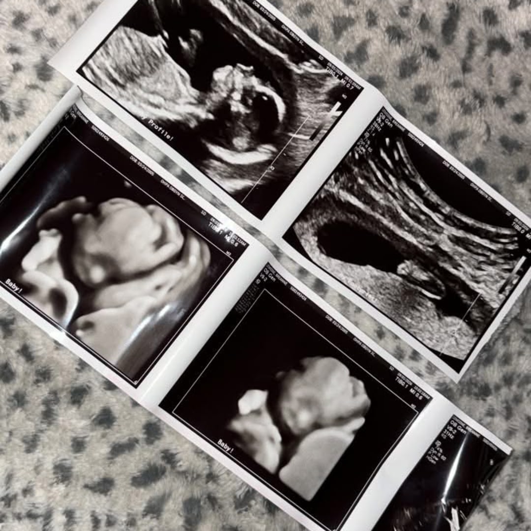 Photo shared by Breanne for their Babylist baby registry.