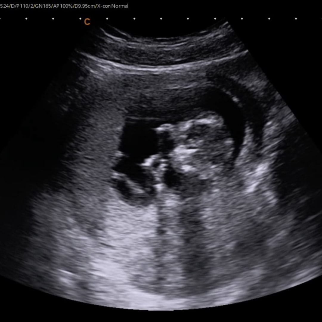 Photo shared by Abby for their Babylist baby registry.