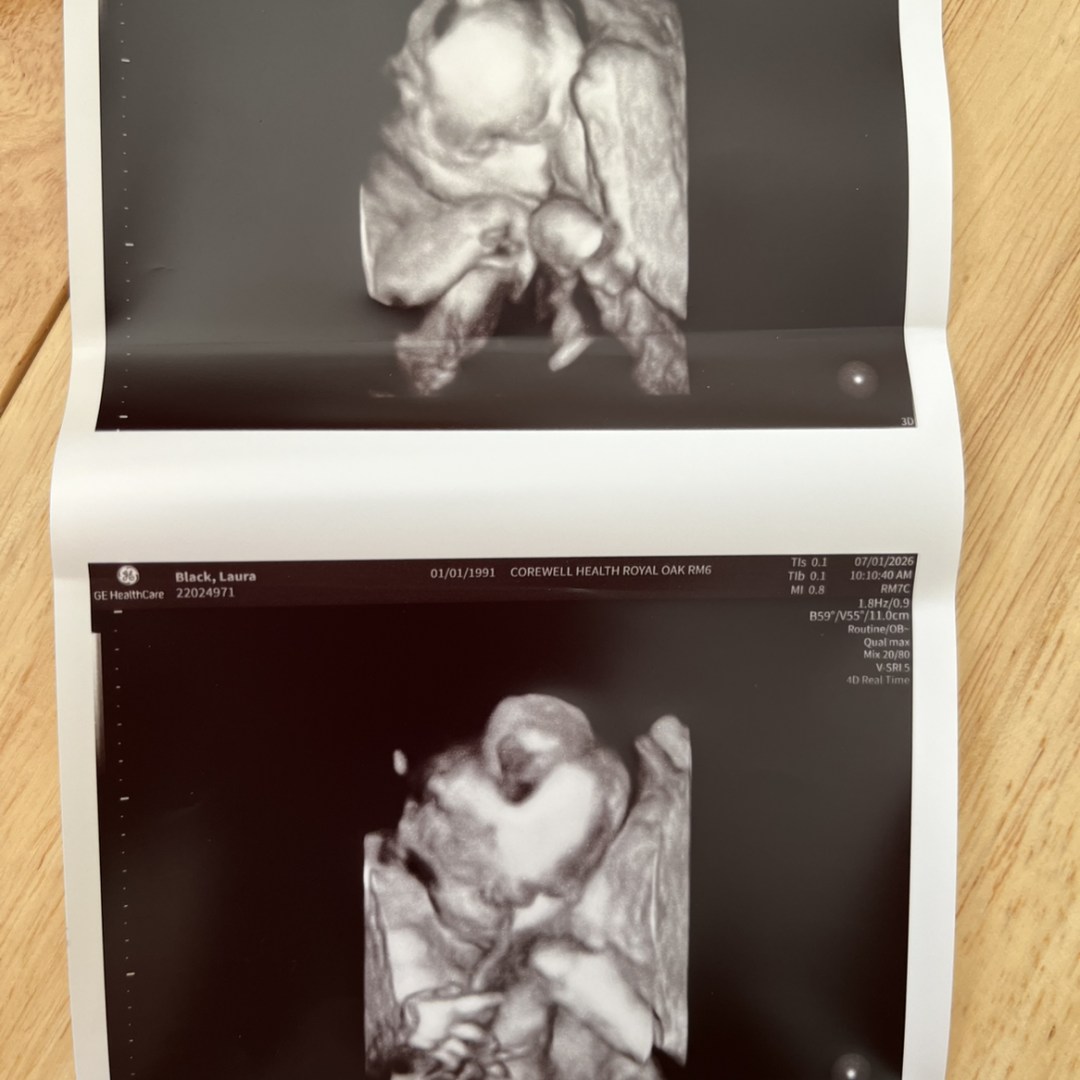 Photo shared by Laura for their Babylist baby registry.