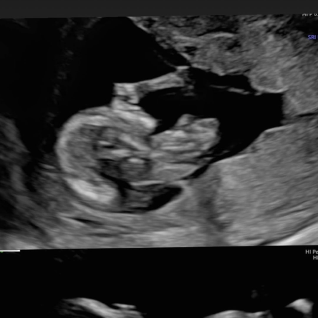 Photo shared by Kaitlin for their Babylist baby registry.