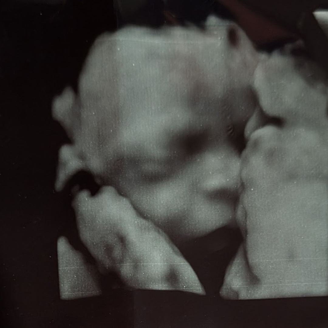 Photo shared by Stephanie for their Babylist baby registry.