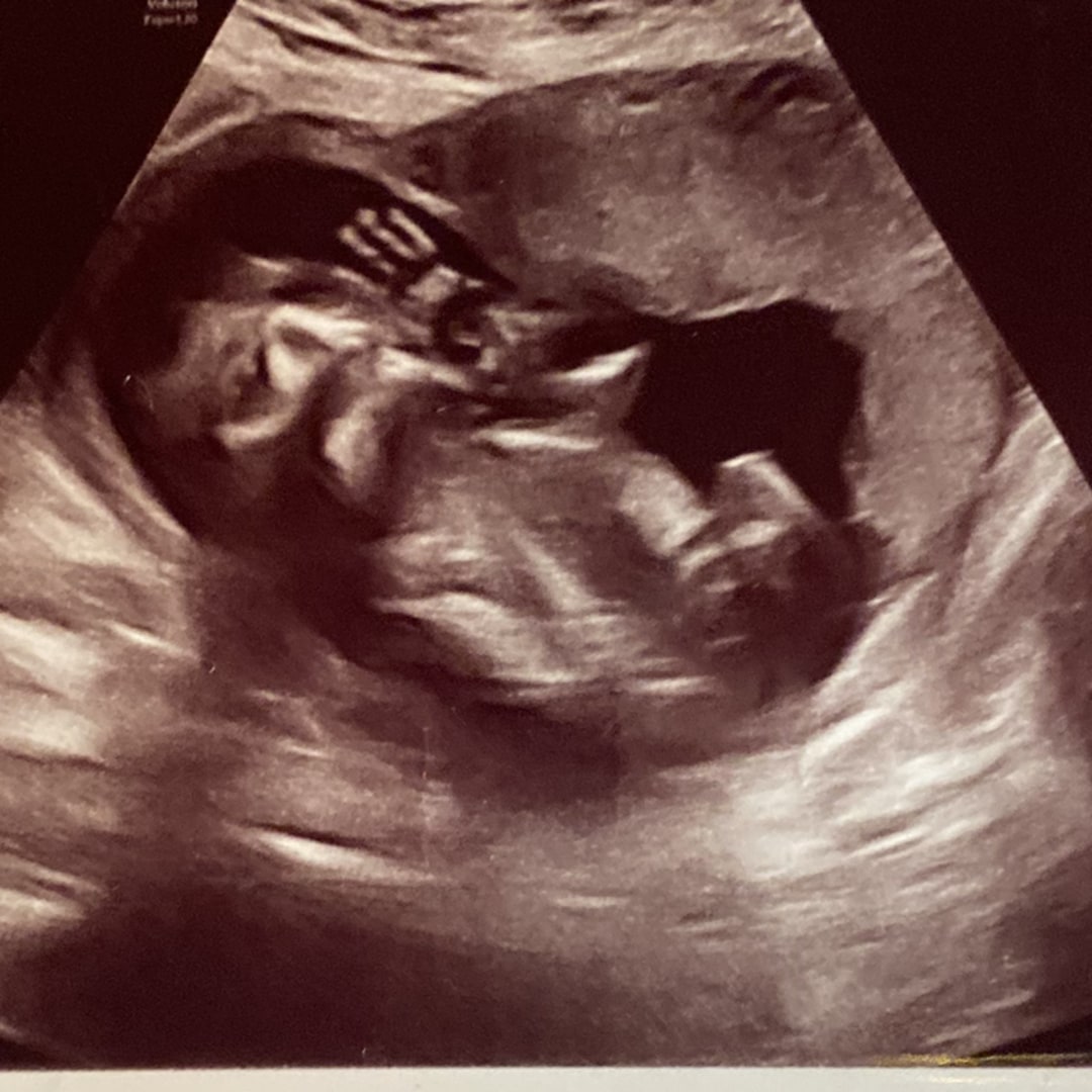 Photo shared by Mary for their Babylist baby registry.