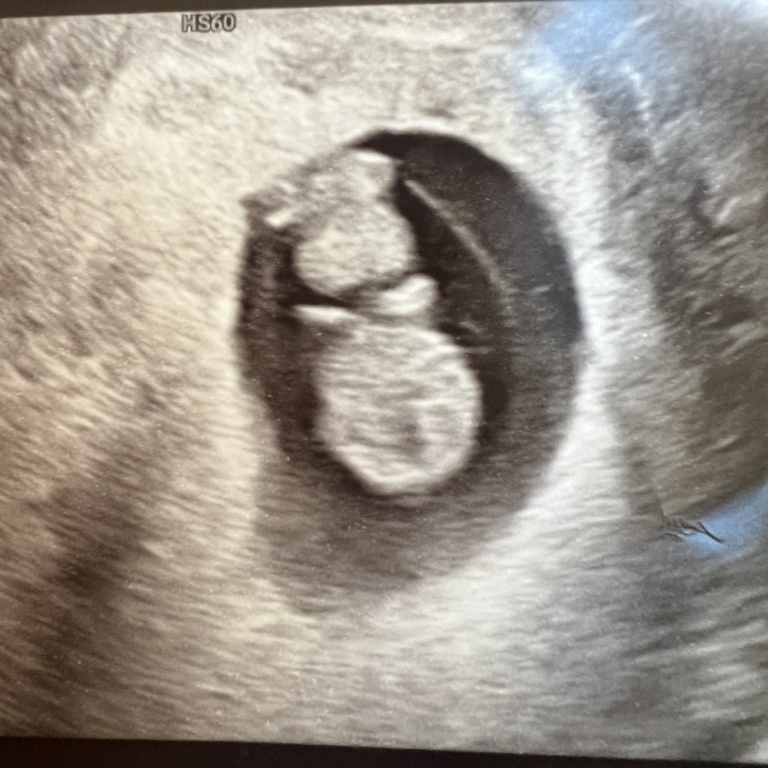 Photo shared by Jenny for their Babylist baby registry.