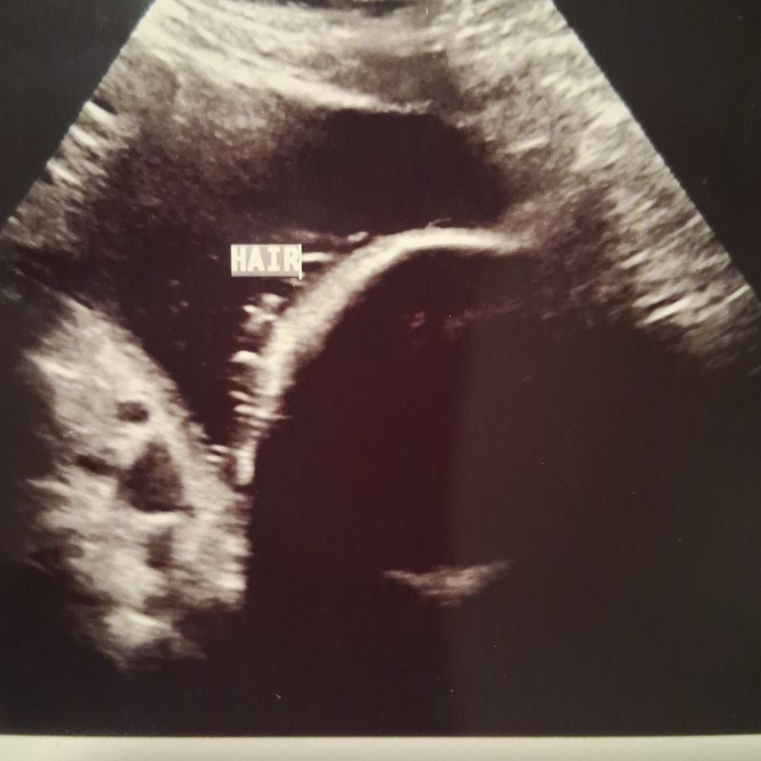 Photo shared by Angel for their Babylist baby registry.