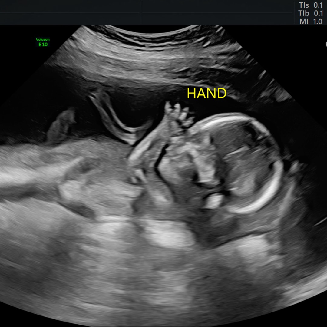 Photo shared by Eryka for their Babylist baby registry.