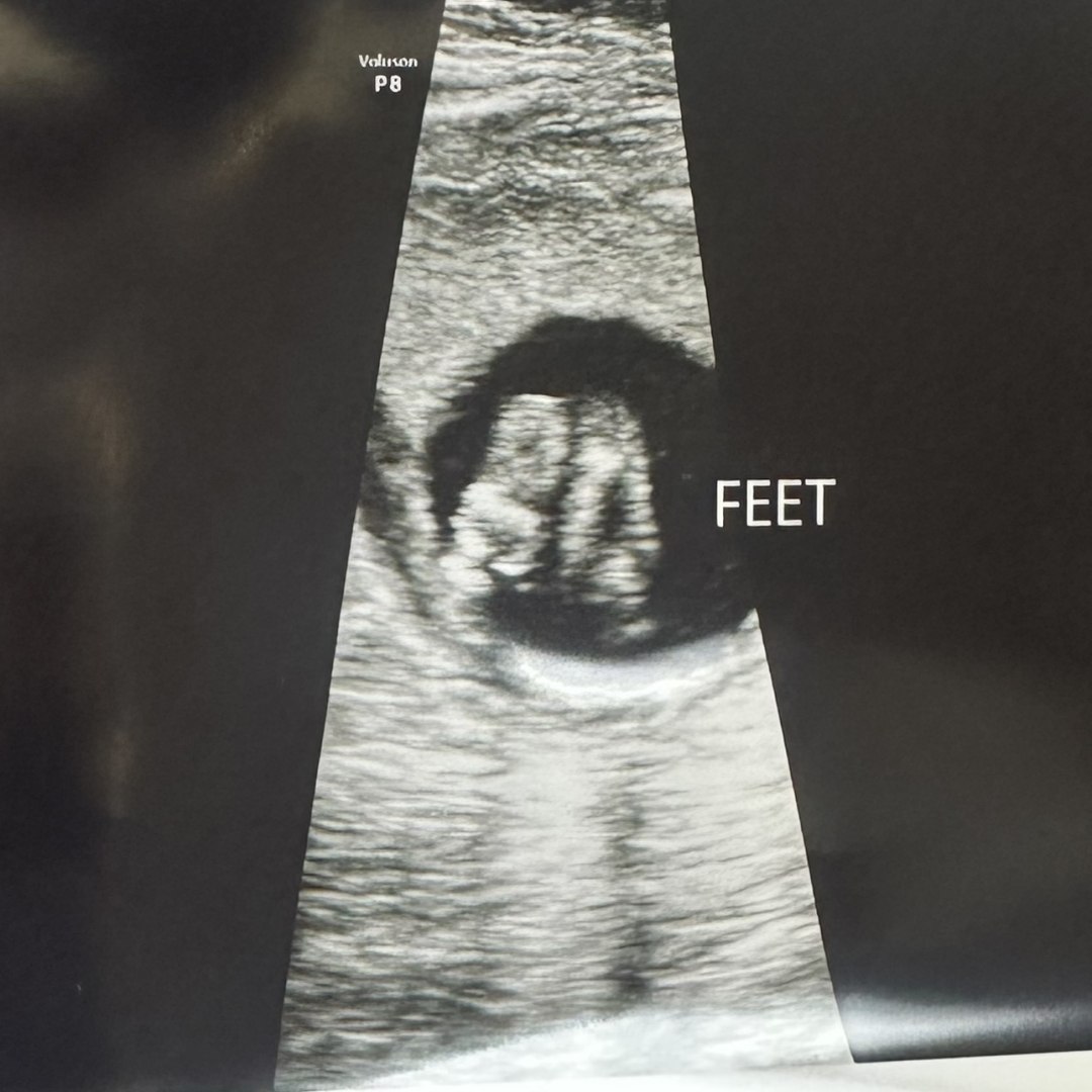 Photo shared by Jana for their Babylist baby registry.