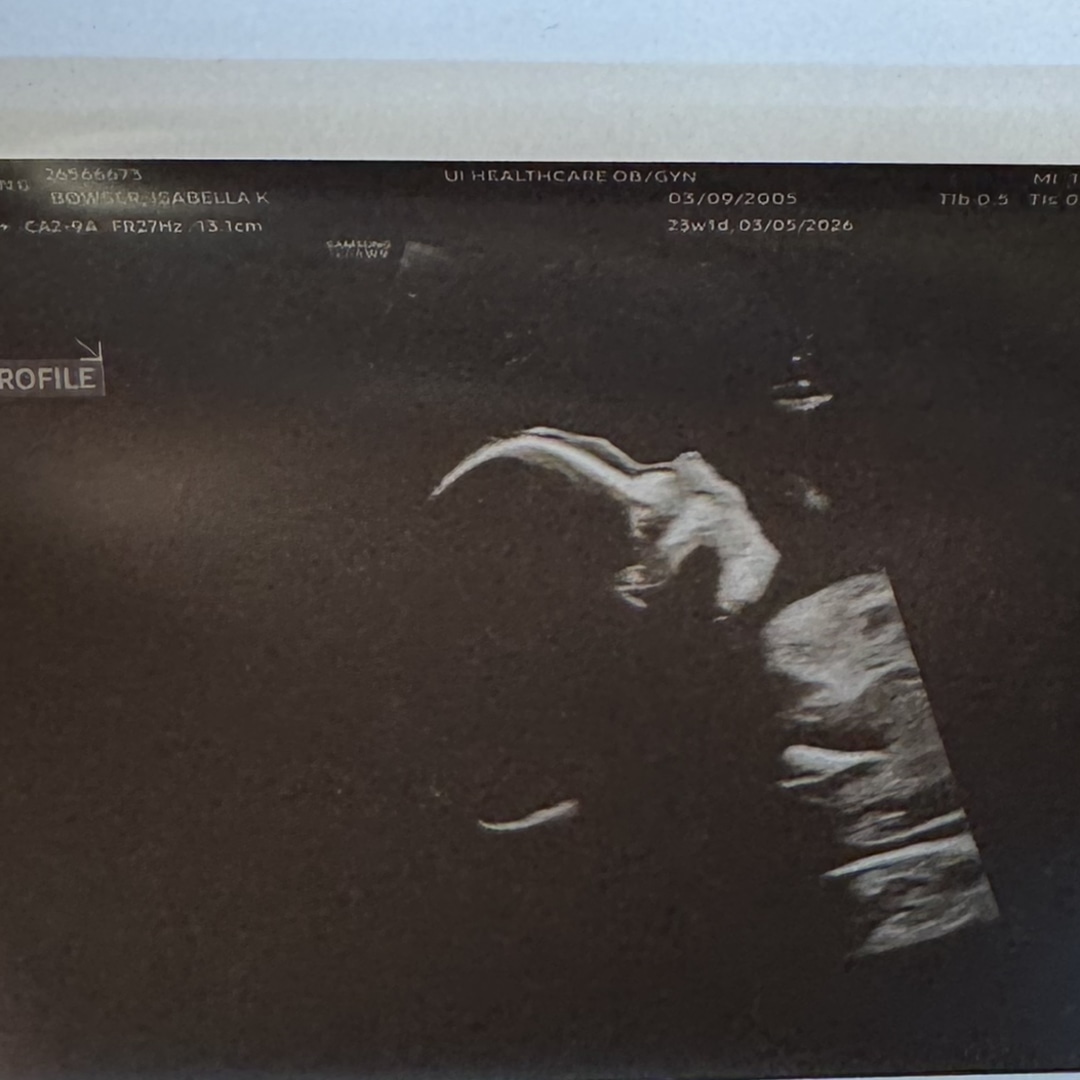 Photo shared by Isabella for their Babylist baby registry.