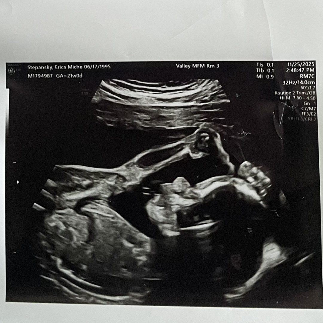 Photo shared by Erica for their Babylist baby registry.