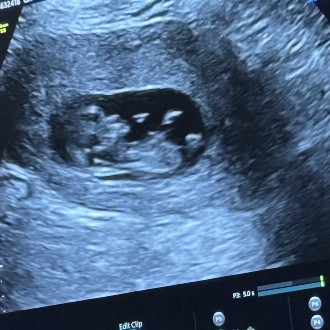 Photo shared by Jellisa for their Babylist baby registry.
