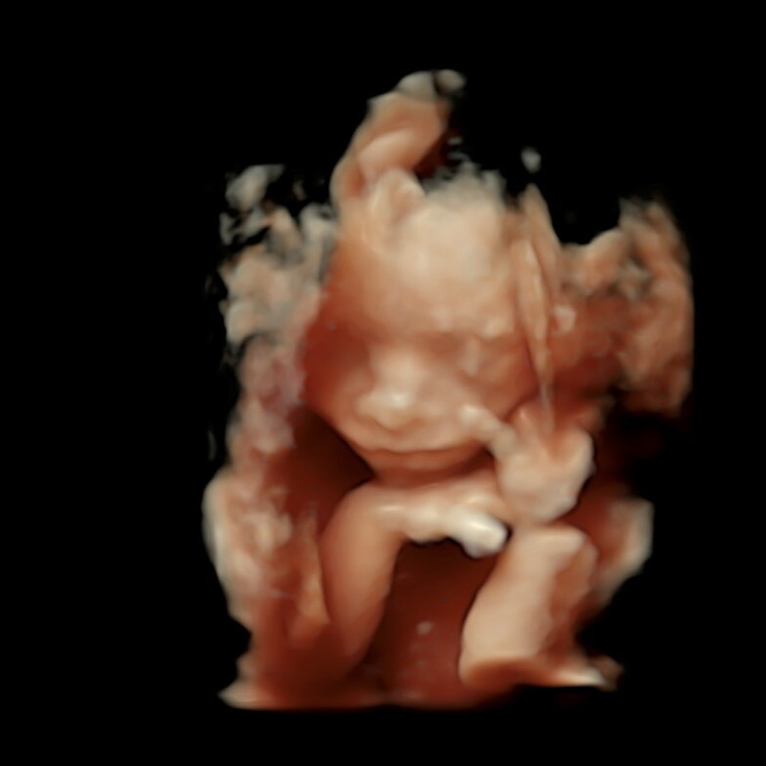 Photo shared by Alex for their Babylist baby registry.