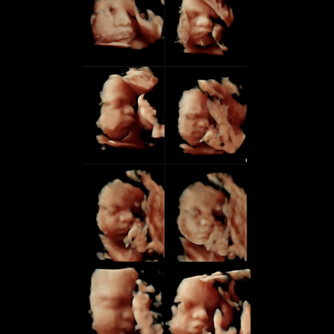 Photo shared by Jordan for their Babylist baby registry.