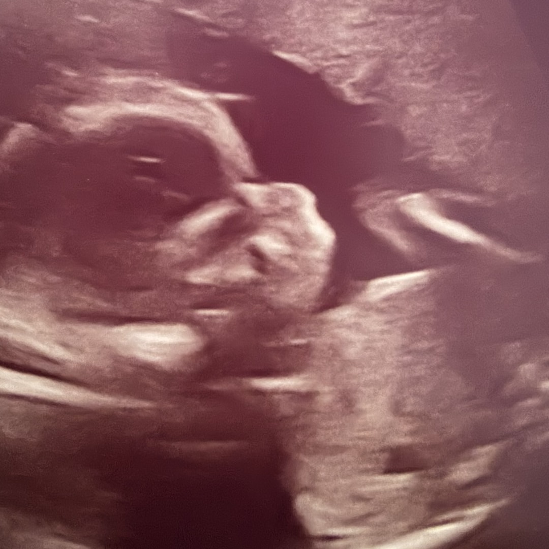 Photo shared by Jordyn for their Babylist baby registry.