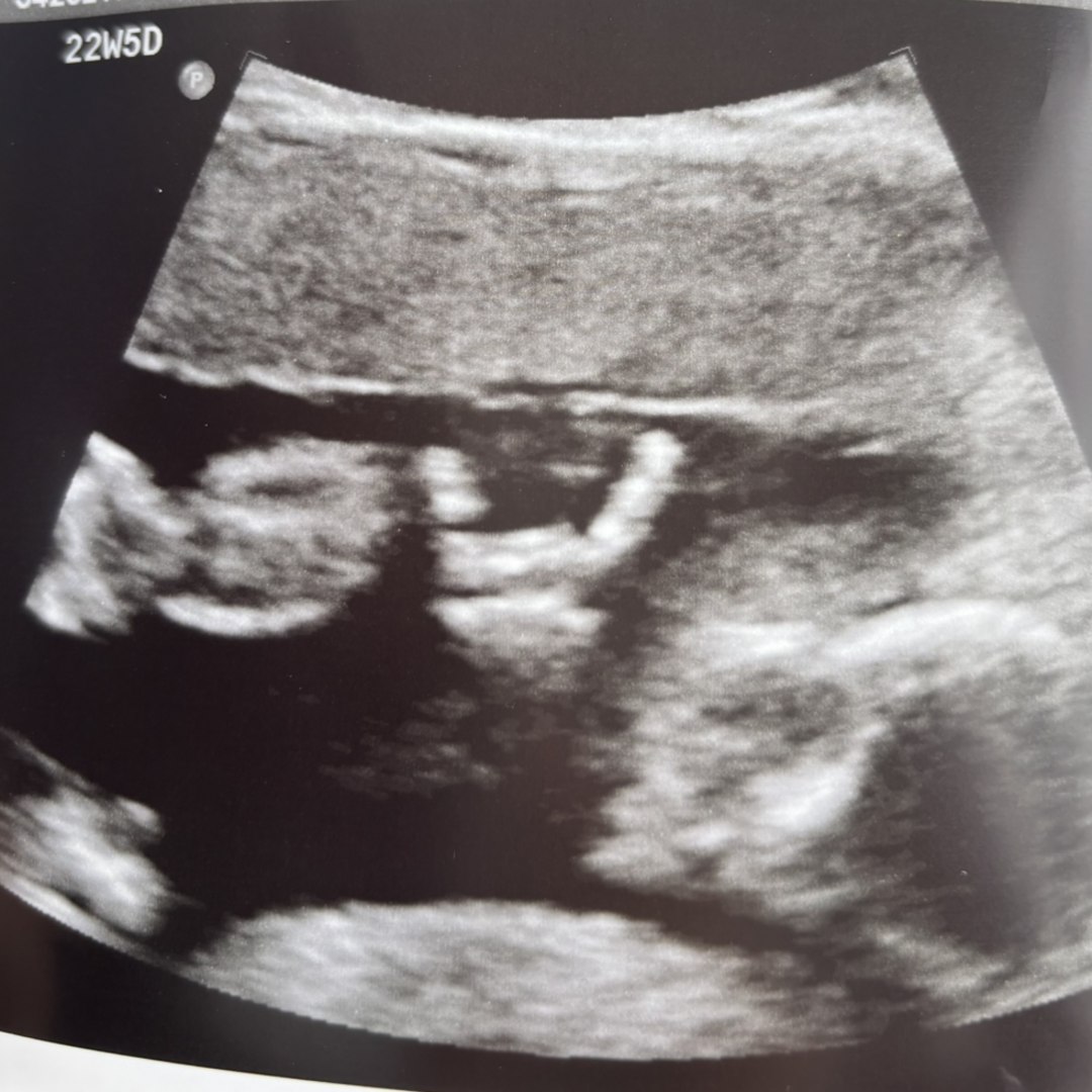 Photo shared by Viviana for their Babylist baby registry.