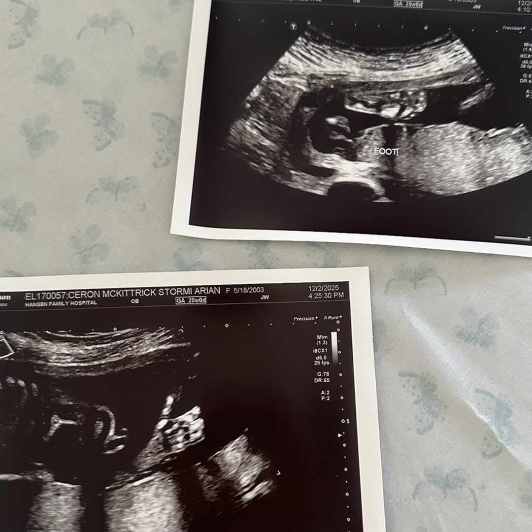 Photo shared by Stormi for their Babylist baby registry.