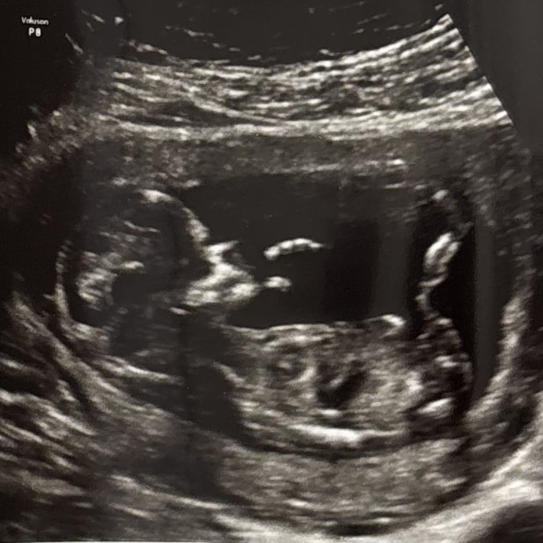 Photo shared by Adessa for their Babylist baby registry.