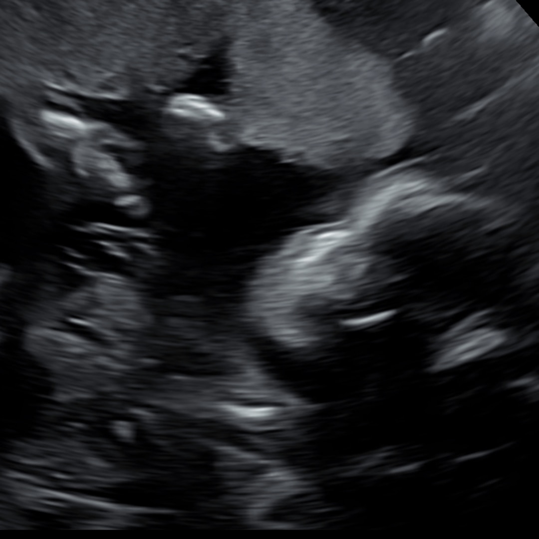 Photo shared by Emily for their Babylist baby registry.