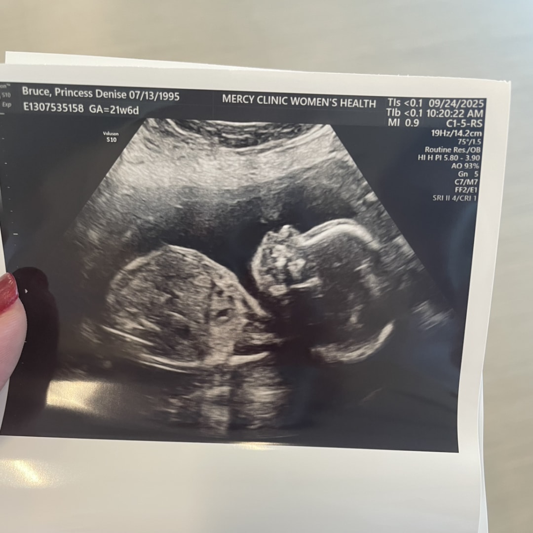 Photo shared by Princess for their Babylist baby registry.