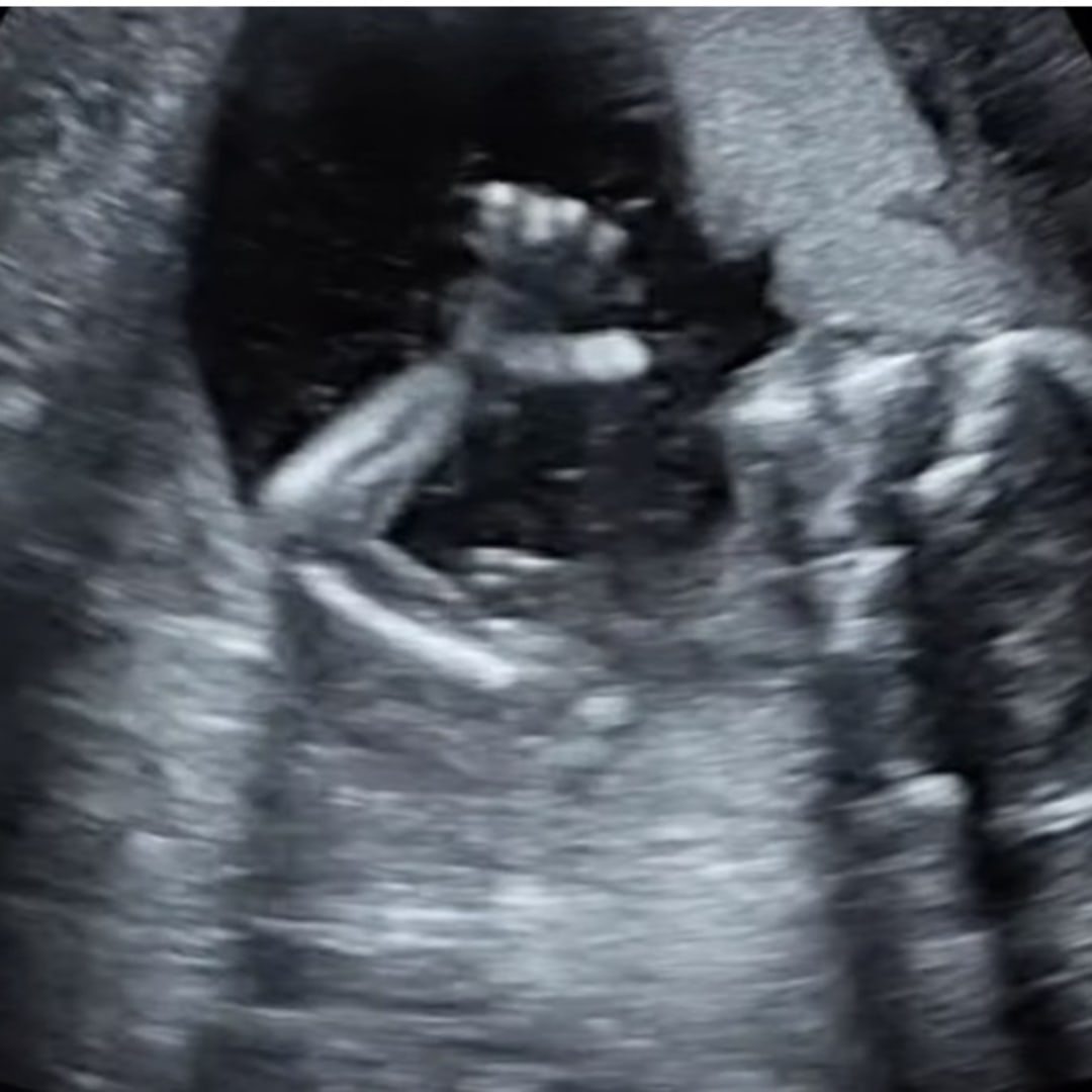 Photo shared by Cristina for their Babylist baby registry.