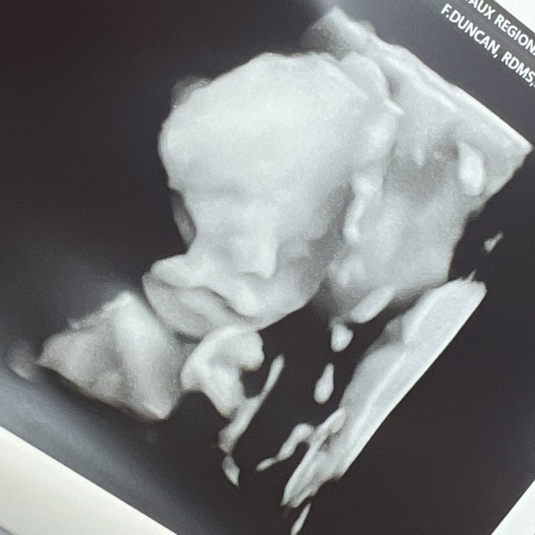 Photo shared by Dasia for their Babylist baby registry.