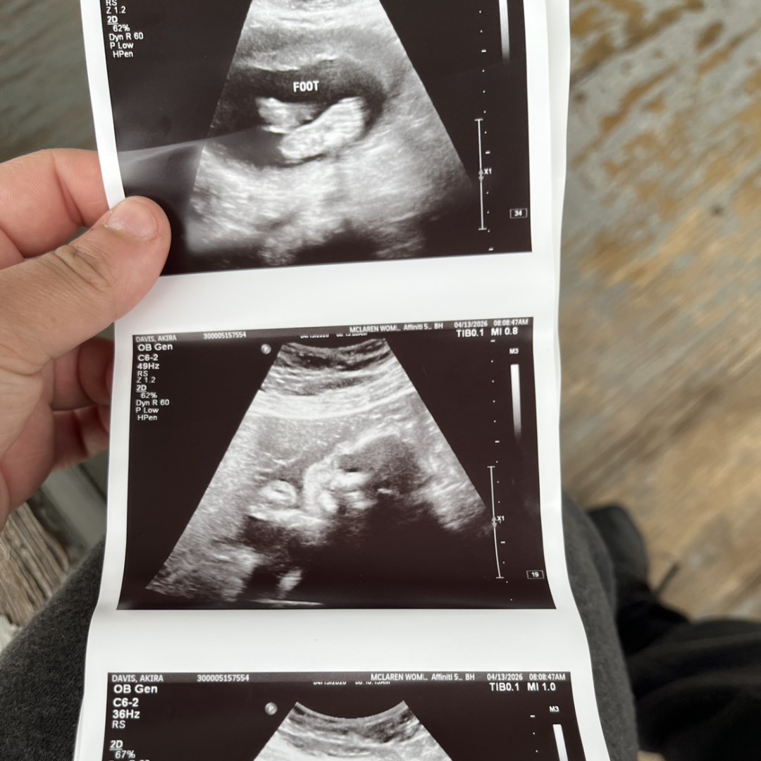 Photo shared by Akira for their Babylist baby registry.