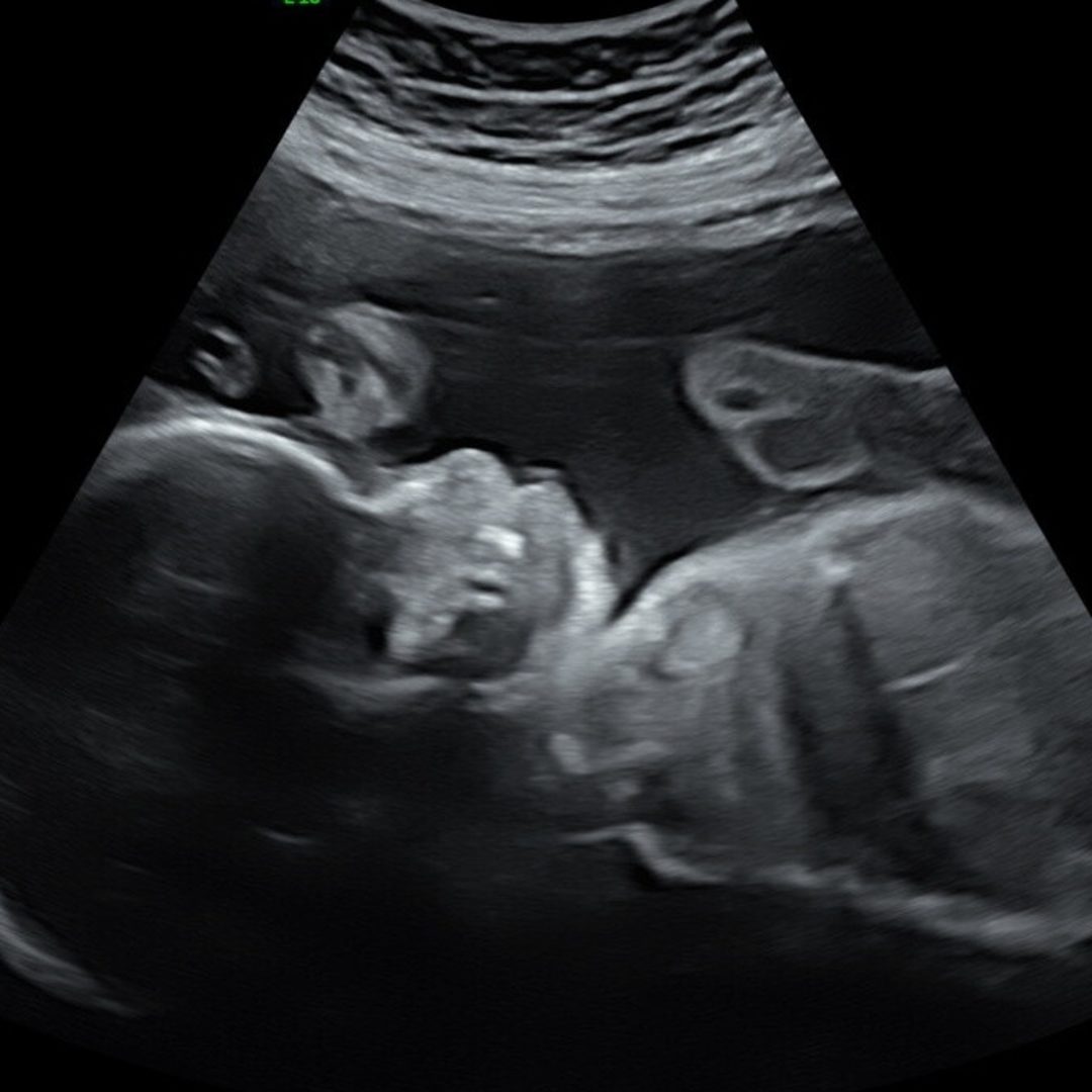 Photo shared by Jazzmyn for their Babylist baby registry.