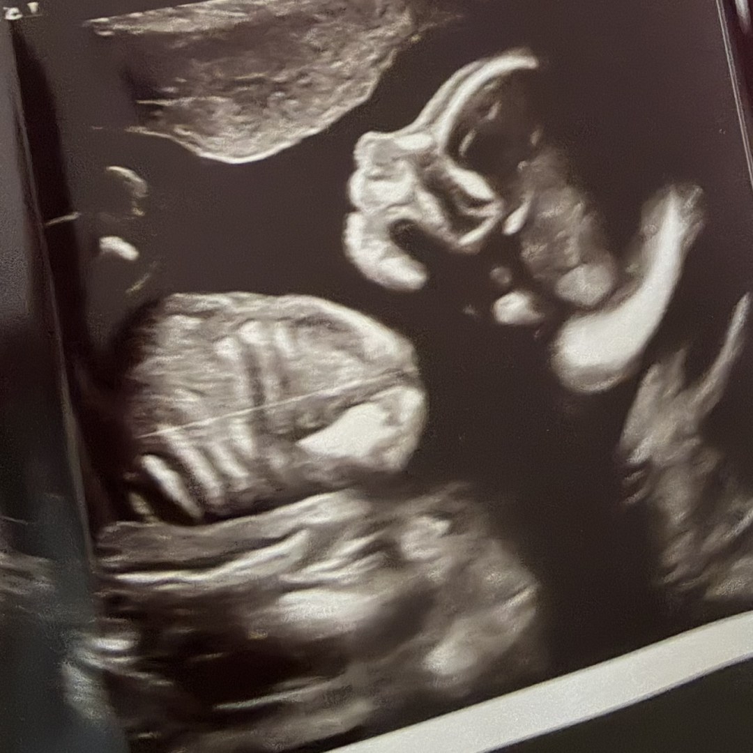 Photo shared by Nicole for their Babylist baby registry.