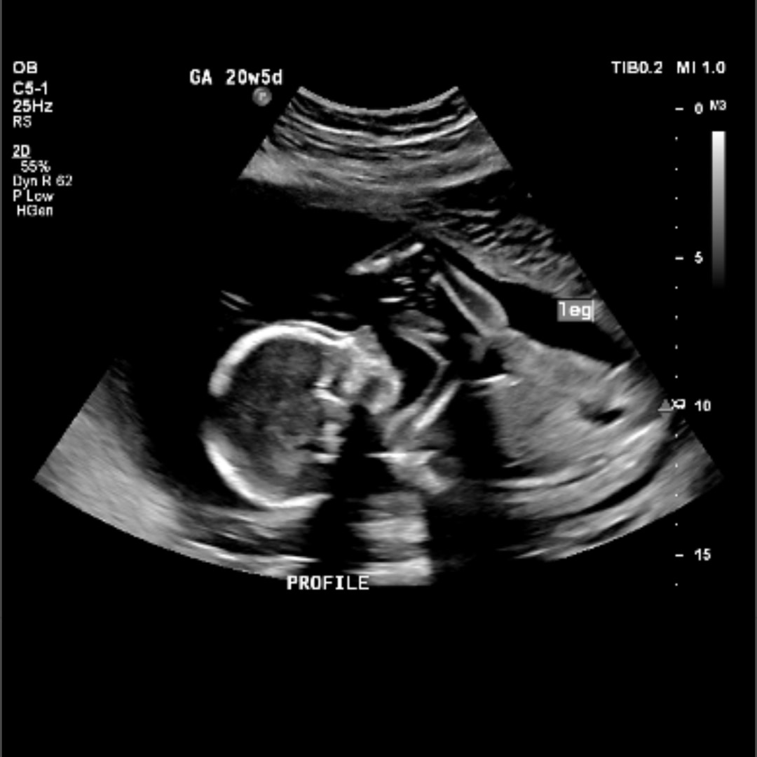 Photo shared by Alex for their Babylist baby registry.