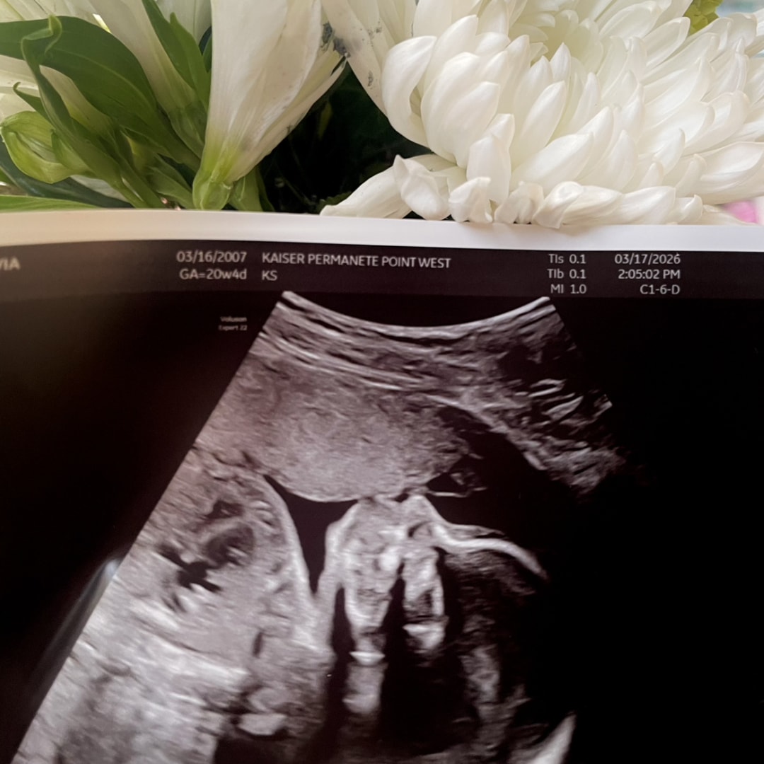 Photo shared by Olivia for their Babylist baby registry.