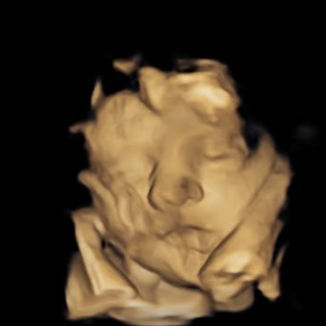 Photo shared by Kaitlin for their Babylist baby registry.