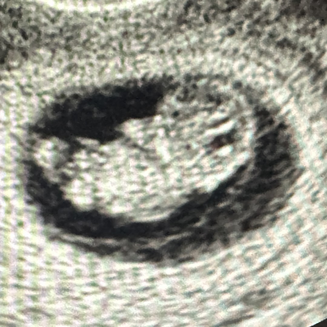 Photo shared by Kendra for their Babylist baby registry.