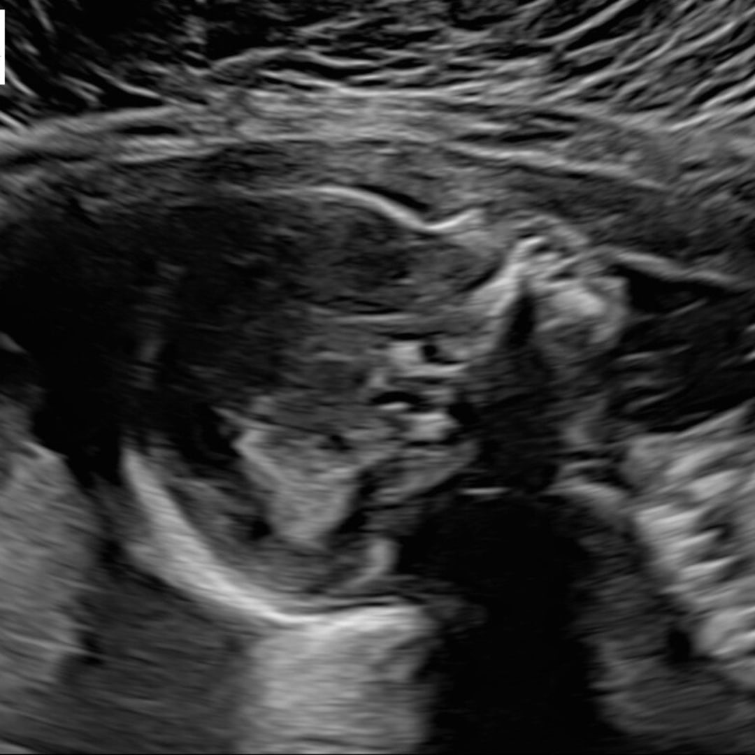 Photo shared by Ashley for their Babylist baby registry.