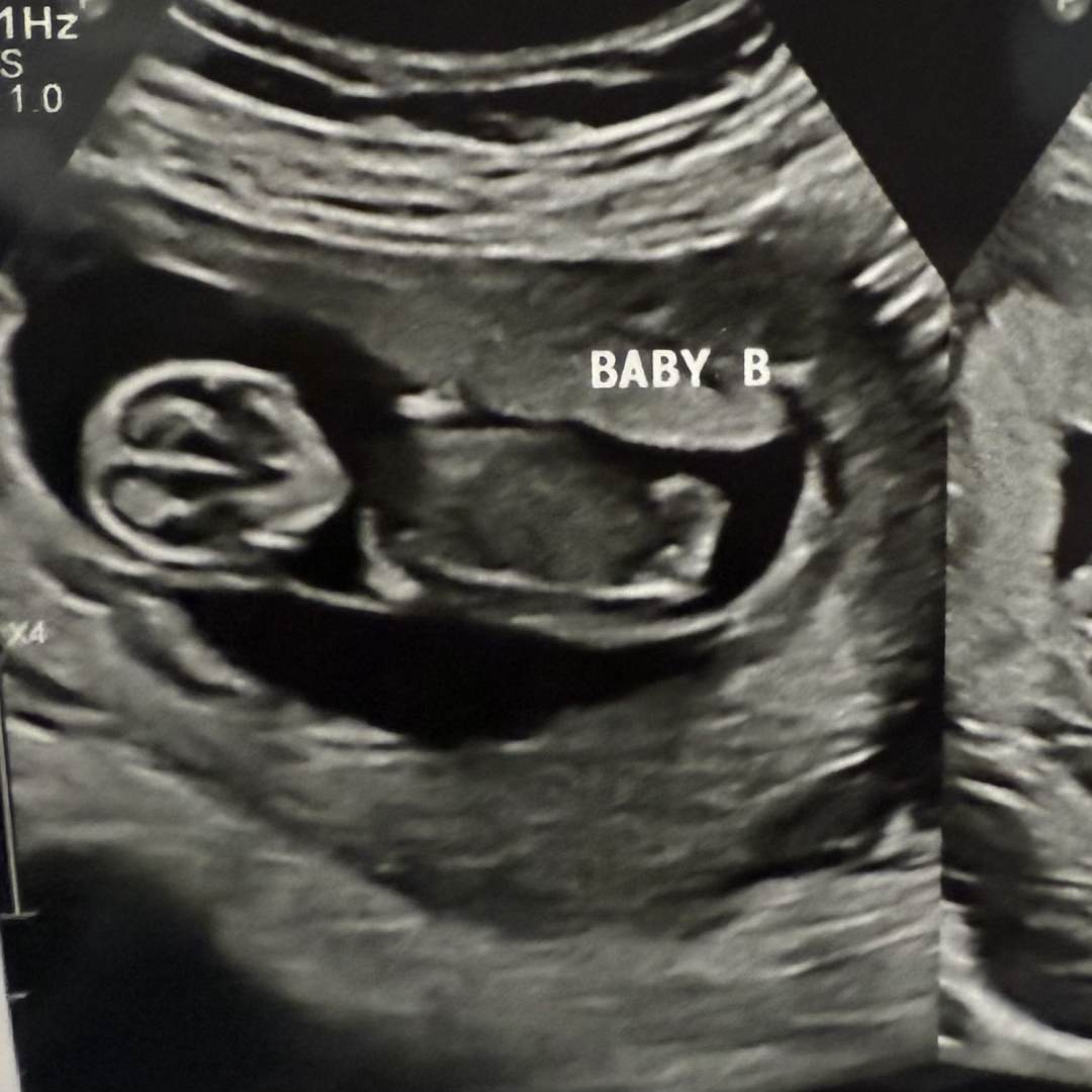 Photo shared by Blake for their Babylist baby registry.