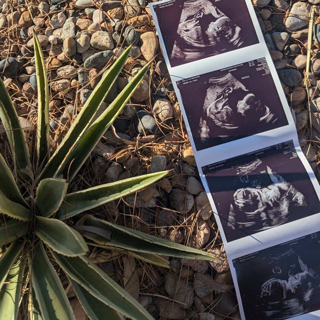 Photo shared by Laura for their Babylist baby registry.