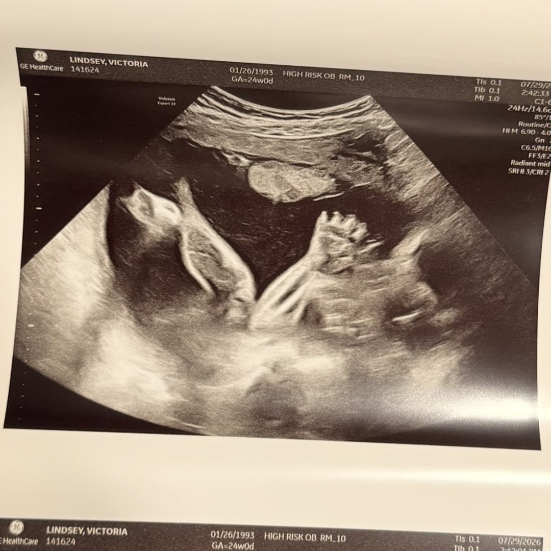 Photo shared by Victoria for their Babylist baby registry.