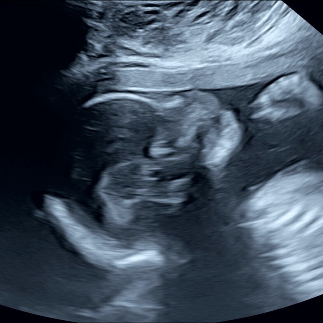 Photo shared by Jennifer for their Babylist baby registry.