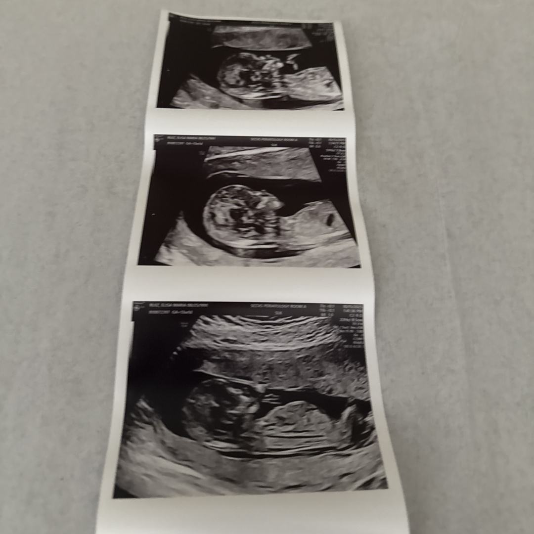 Photo shared by Elisa for their Babylist baby registry.