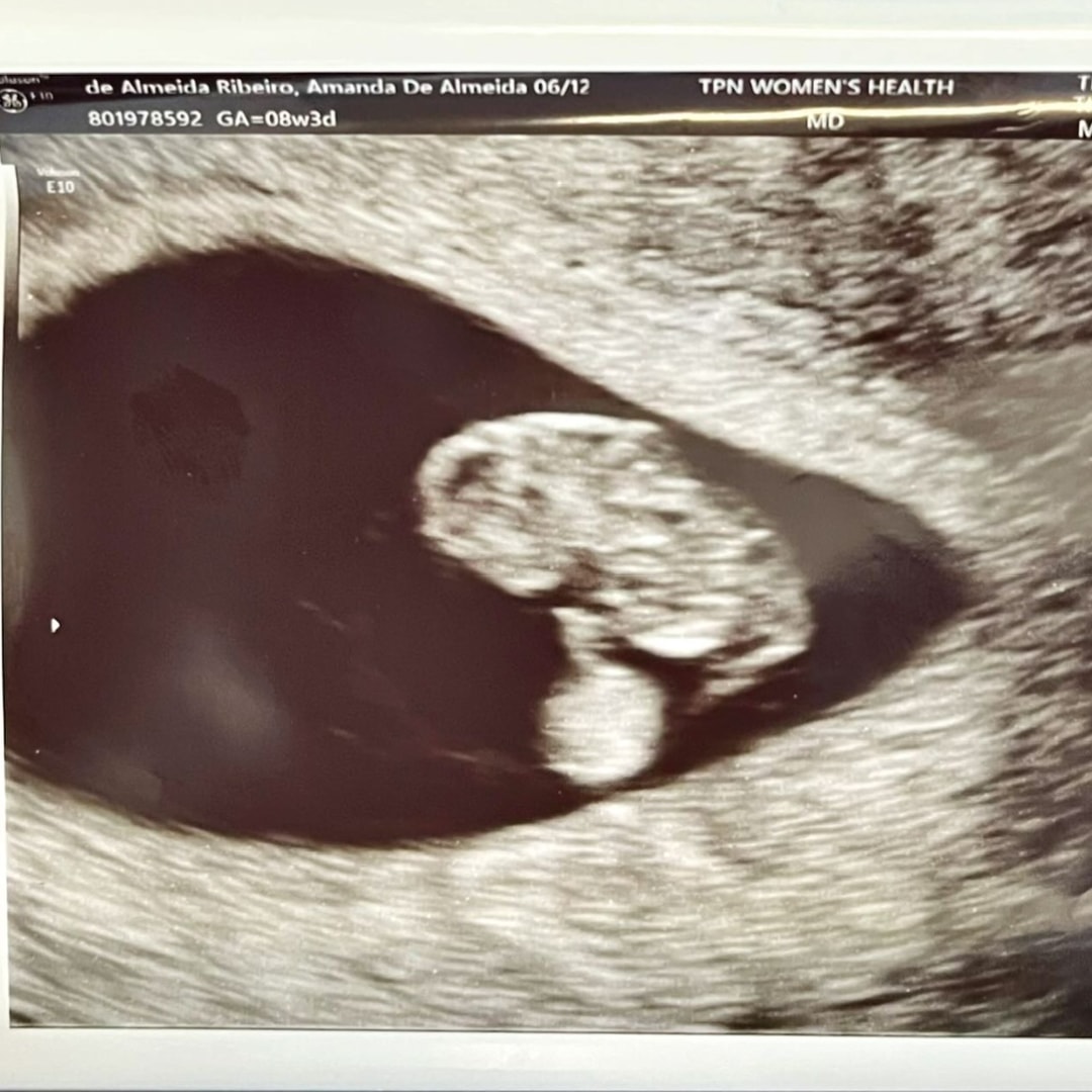 Photo shared by Amanda for their Babylist baby registry.