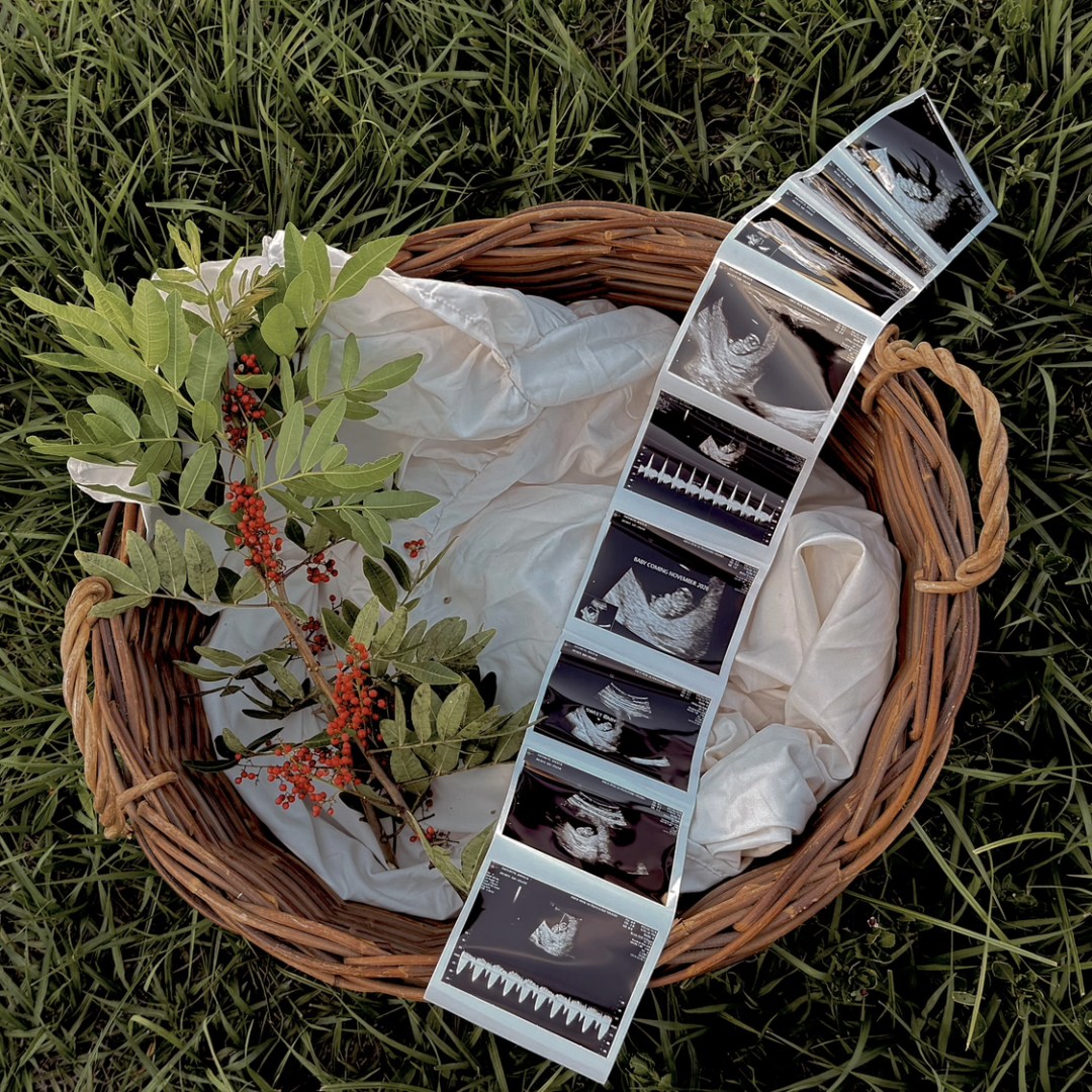 Photo shared by Angela for their Babylist baby registry.