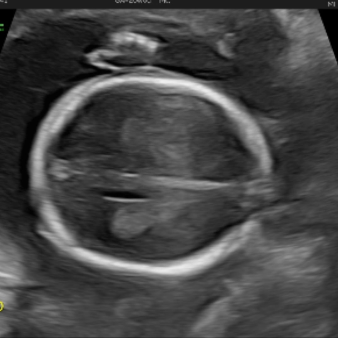 Photo shared by Zoe for their Babylist baby registry.