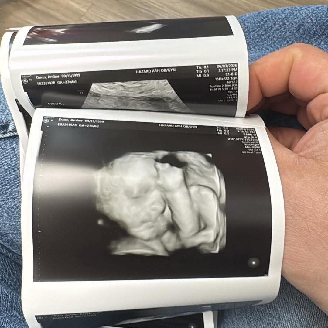 Photo shared by Amber for their Babylist baby registry.