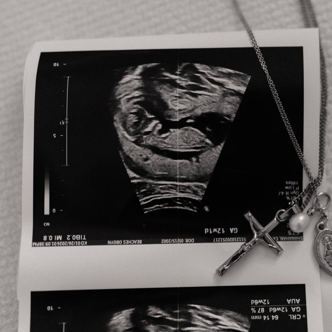 Photo shared by Caili for their Babylist baby registry.