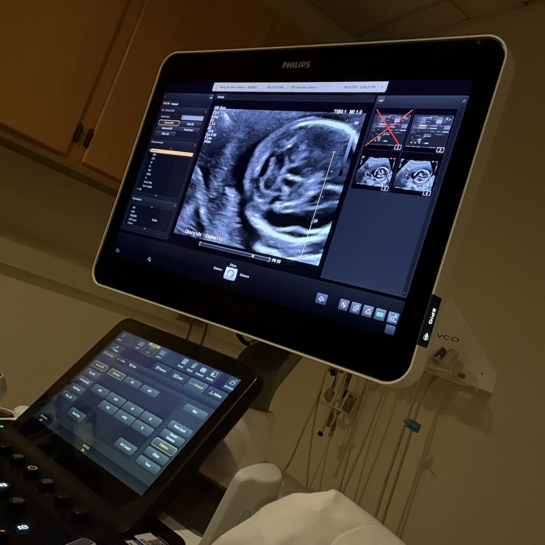 Photo shared by Kloe for their Babylist baby registry.