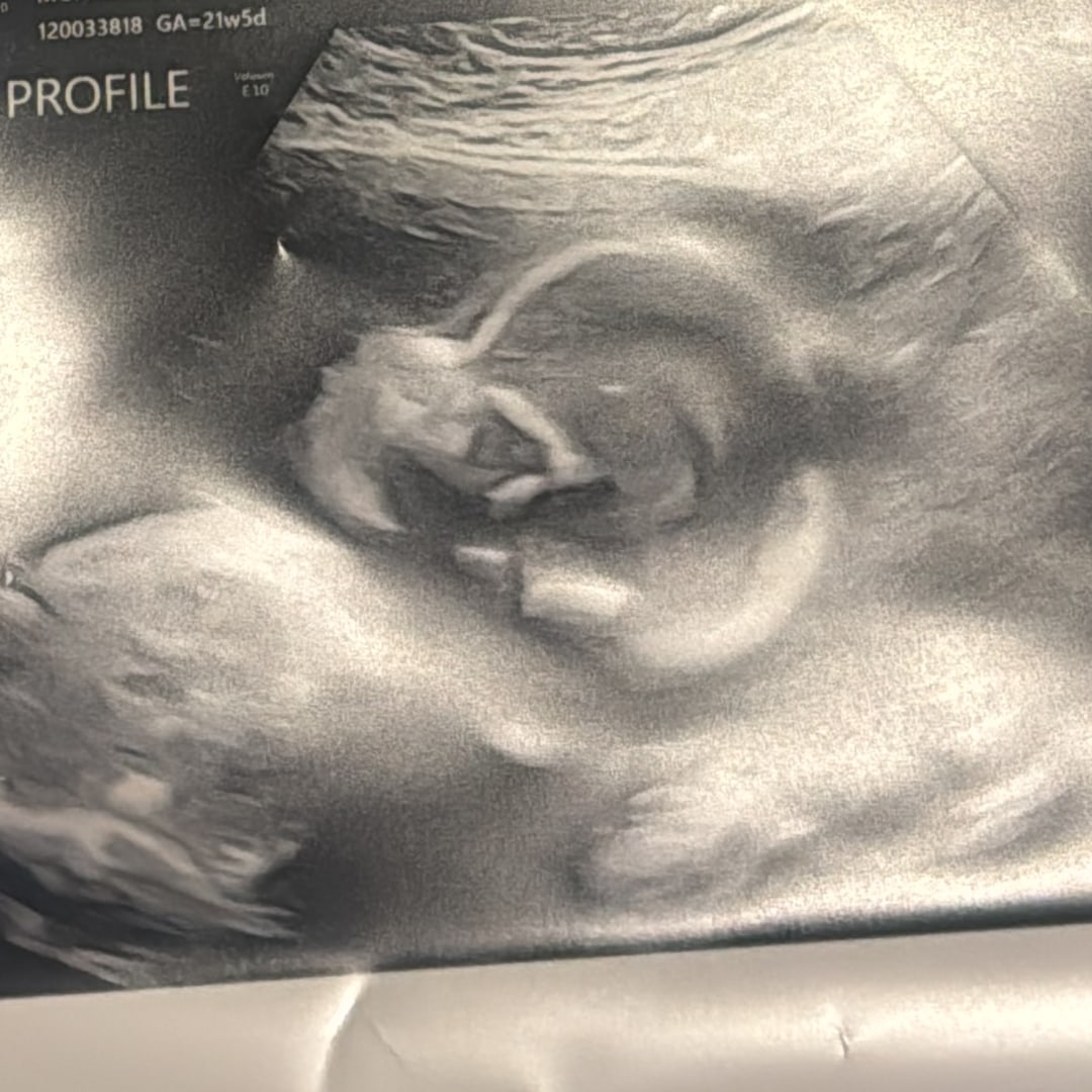 Photo shared by Anisa for their Babylist baby registry.