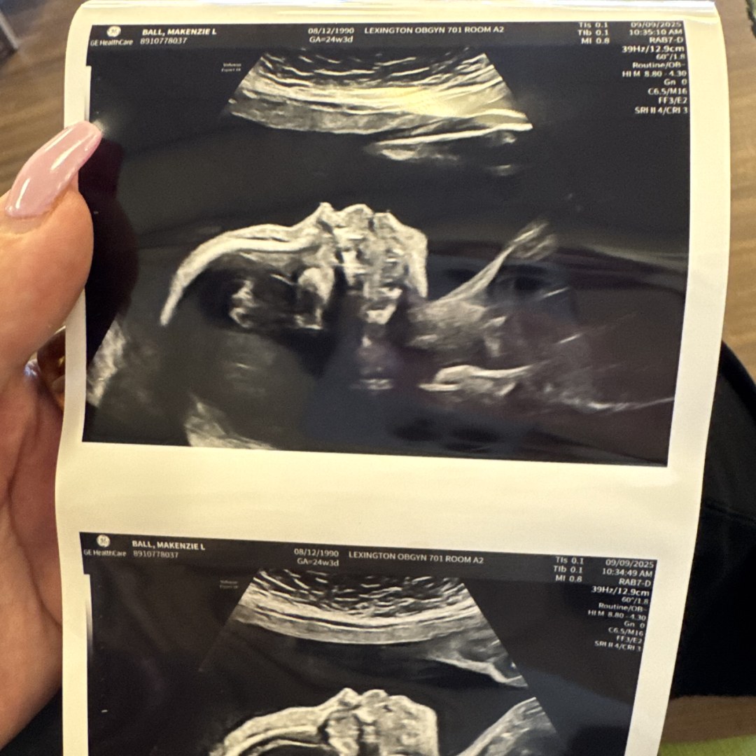 Photo shared by MaKenzie for their Babylist baby registry.