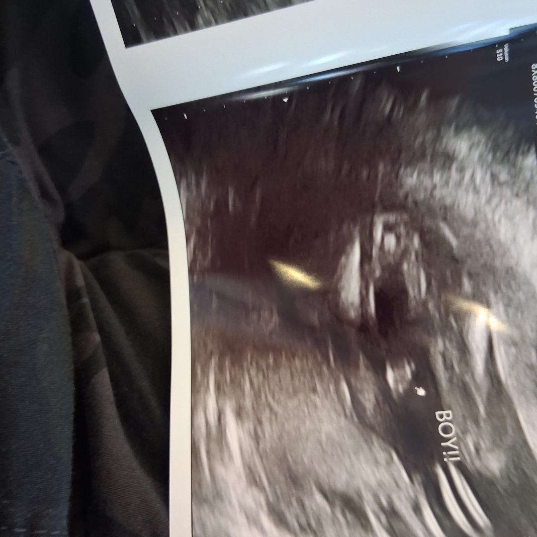 Photo shared by Brooklyn for their Babylist baby registry.