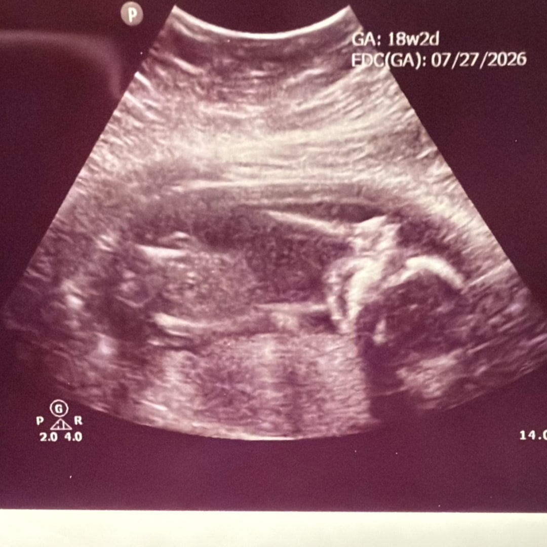 Photo shared by Courtney for their Babylist baby registry.