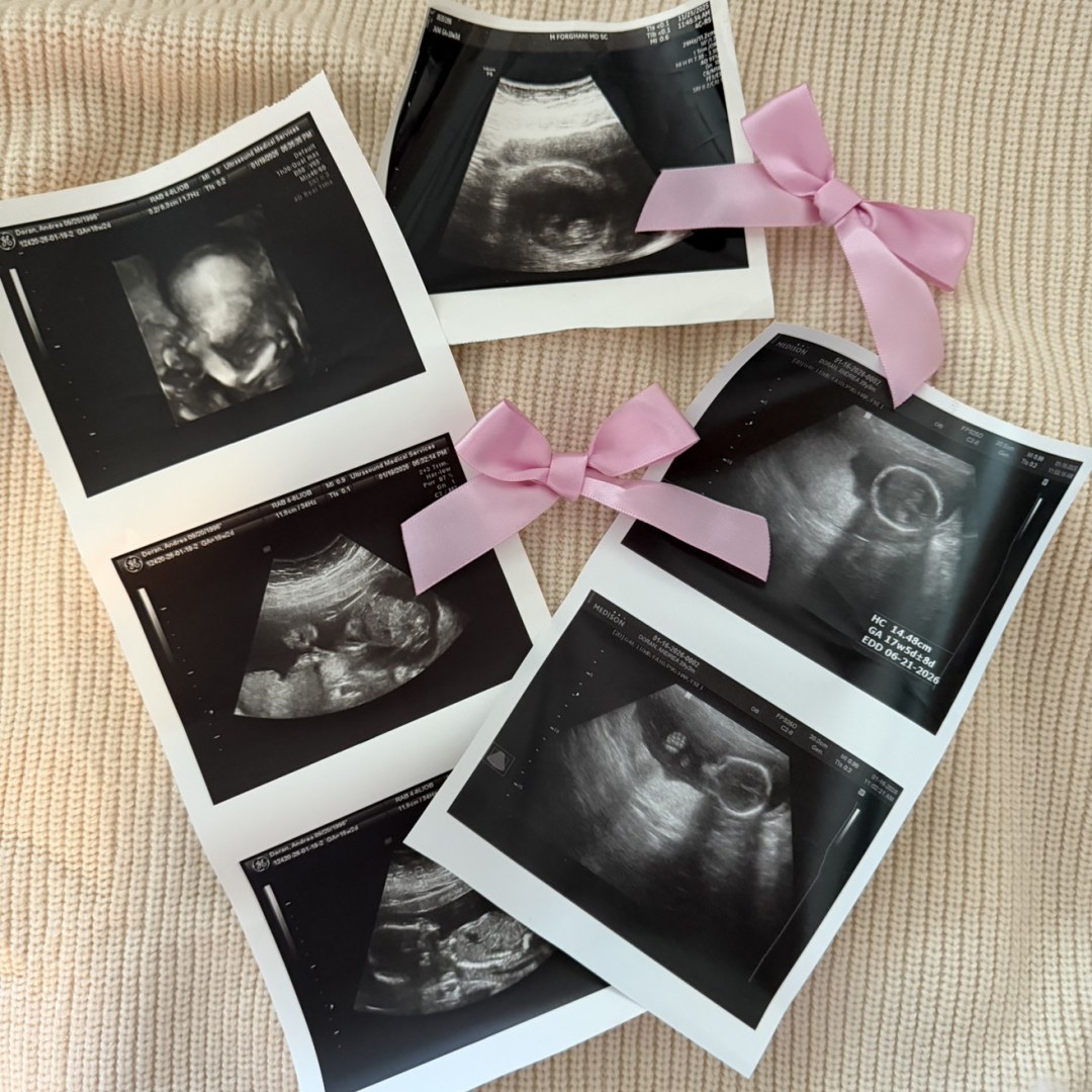 Photo shared by ANDREA for their Babylist baby registry.