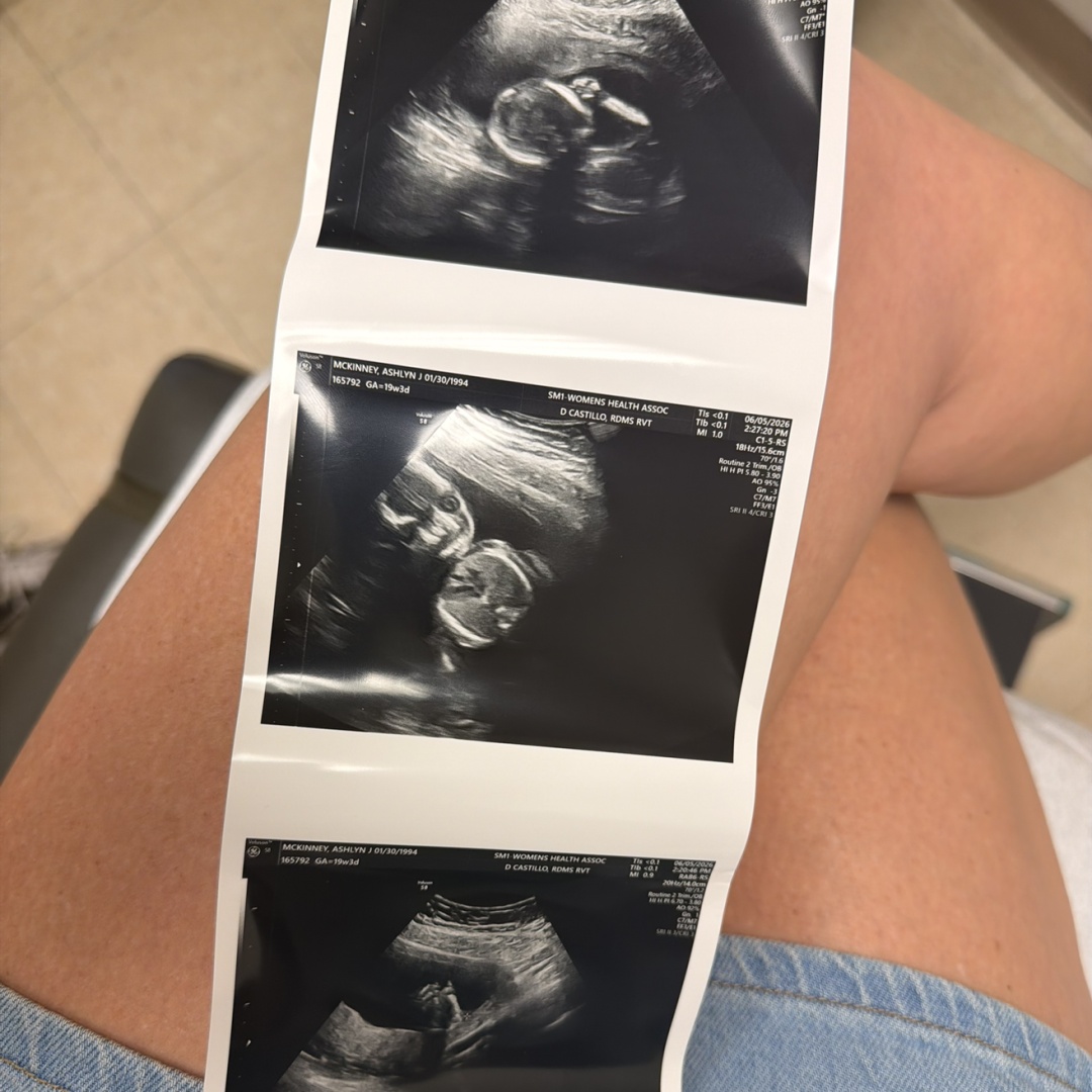 Photo shared by Ashlyn for their Babylist baby registry.